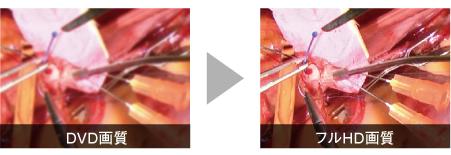 DVD画質とフルHD画質比較イメージ写真