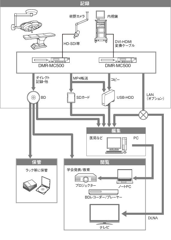 記録ワークフロー