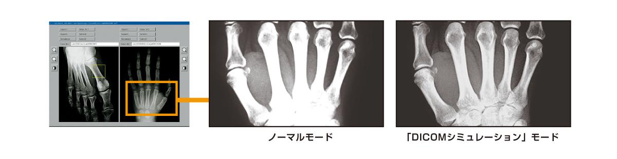 DICOMシミュレーションモード