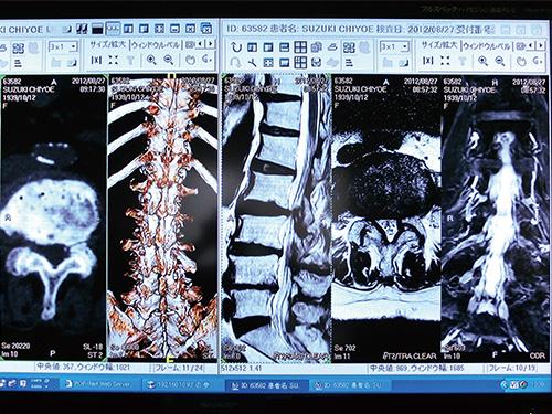 写真：CT、MRI、レントゲンの画像を一度に2つのモニターへ表示して使用